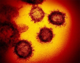 Il virus appare più indebolito, conferme alla teoria venuta da Catania
