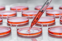 In Sicilia crescono i casi di tumore con 5 neoplasie più frequenti