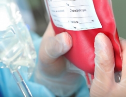Trasfusione con sangue infetto, 800mila euro di risarcimento agli eredi