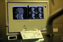 Salute, al via la campagna 'proteggi il tuo cervello, affidati al neurologo'