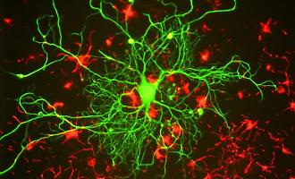 Lo studio dell'istituto di Cristallografia di Catania sulla molecola smart contro l'Alzheimer, aiuta le difese naturali