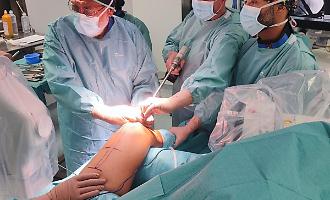 Eccezionale intervento al San Marco di Catania: primo allungamento simultaneo di femore e tibia