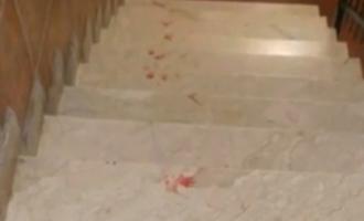Catania, il &ldquo;bullo&rdquo; gambizzato per 40 euro Il movente shock: &laquo;Lo ha educato&raquo;
