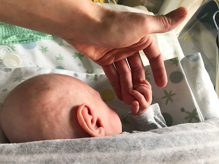 Neonata prematura di 24 settimane operata (e salvata) all'ospedale di Patti