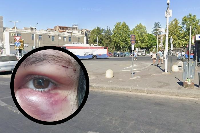 Catania,  il racconto di una 17enne: &laquo;Prima gli insulti omofobi poi un cazzotto in faccia&raquo;