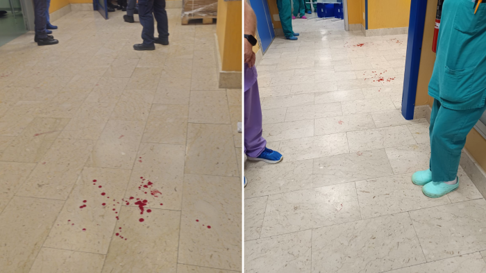Violenza in ospedale, il Cannizzaro introduce un sistema anti aggressioni: telecamere collegate alla Questura